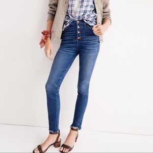 Madewell high rise button fly chewed hem edition